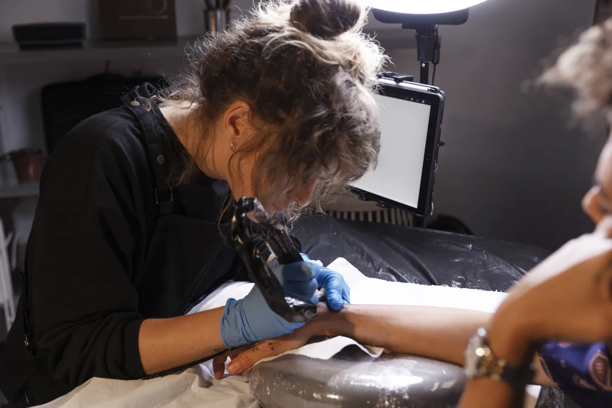 Remover uma tatuagem