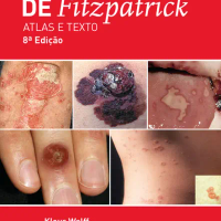 Dermatologia de Fitzpatrick