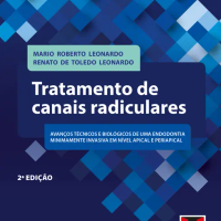 Tratamento de Canais Radiculares