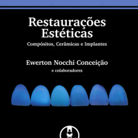 Restaurações Estéticas