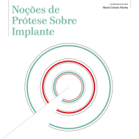 Noções de Prótese Sobre Implante