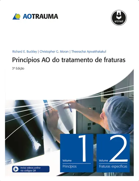 Princípios AO do Tratamento de Fraturas - 2 Volumes Princípios AO do Tratamento de Fraturas - 2 Volumes