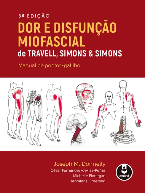 Dor e Disfunção Miofascial de Travell, Simons & Simons Dor e Disfunção Miofascial de Travell, Simons & Simons