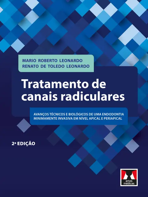 Tratamento de Canais Radiculares Tratamento de Canais Radiculares