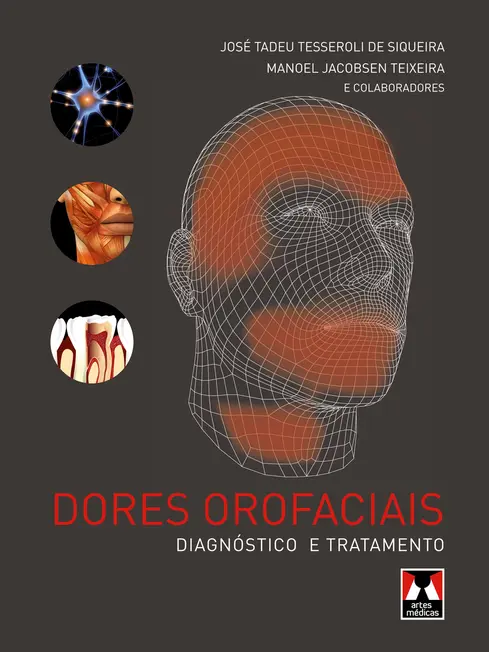 Dores Orofaciais Dores Orofaciais