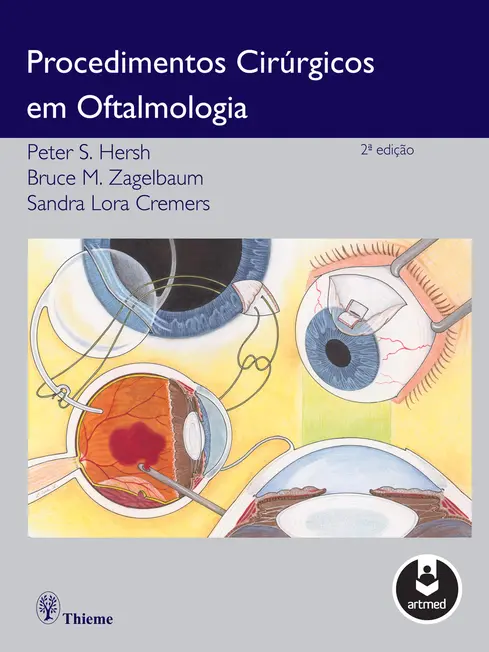 Procedimentos Cirúrgicos em Oftalmologia Procedimentos Cirúrgicos em Oftalmologia