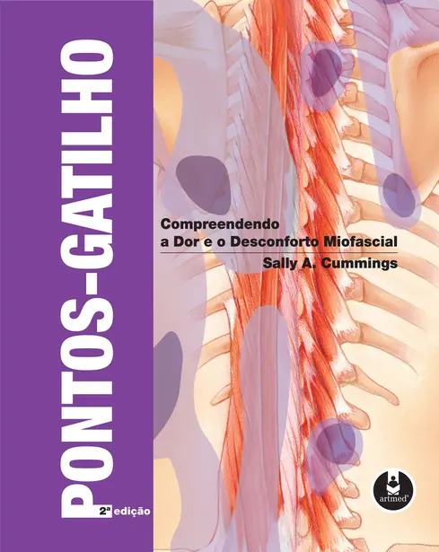 Pontos-Gatilho Pontos-Gatilho