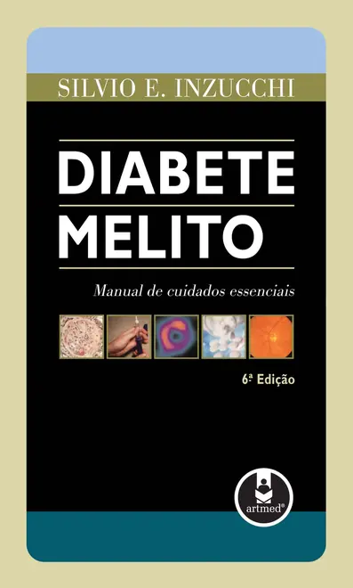 Diabete Melito Diabete Melito