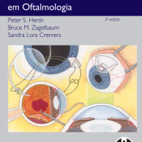 Procedimentos Cirúrgicos em Oftalmologia